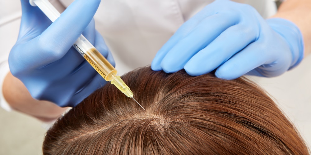 prp hairfall treatment